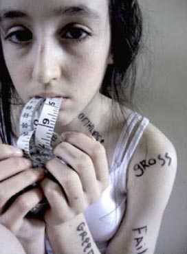 anorexia