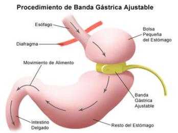 banda